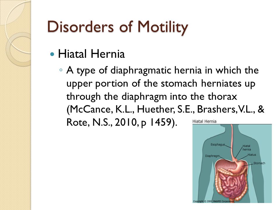 Disorders of Motility Hiatal Hernia