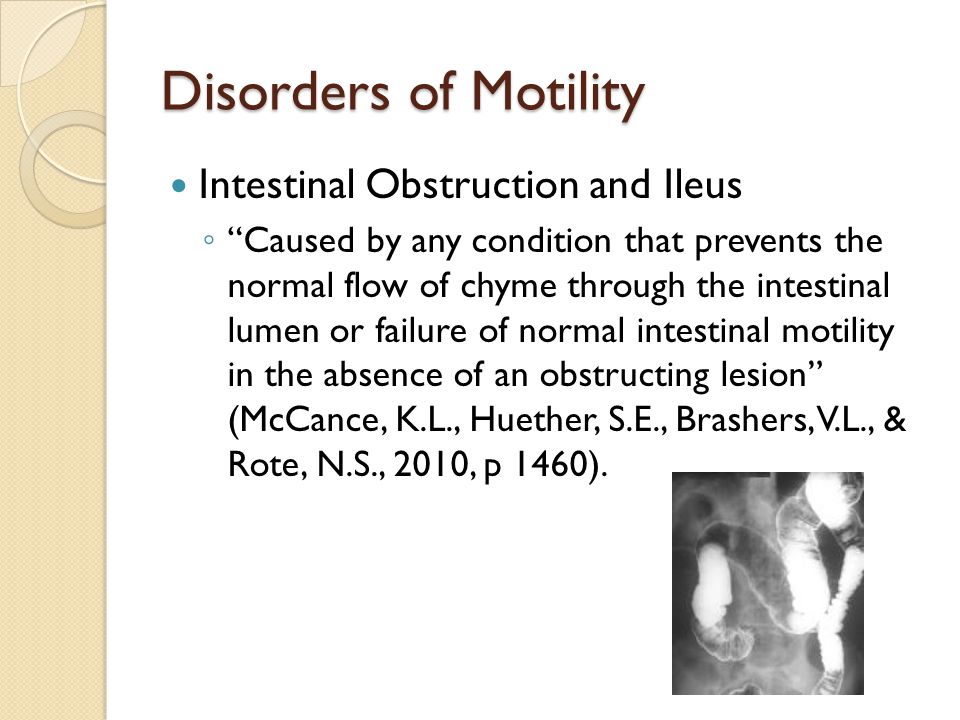 Disorders of Motility Intestinal Obstruction and Ileus