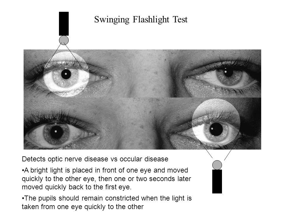 Eyes Inspection Visual Acuity Visual Fields Pupillary Response - ppt video  online download
