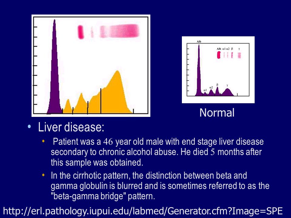 Normal+Liver+disease%3A.jpg