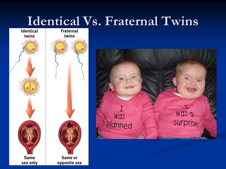 Identical Vs. Fraternal Twins