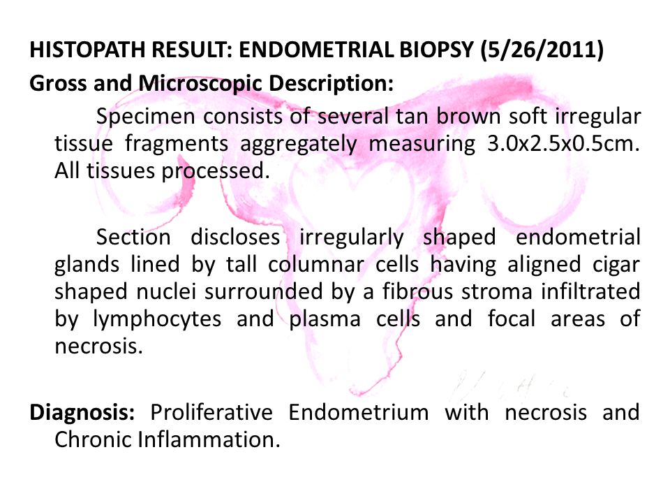 Endometrium result proliferative biopsy What is