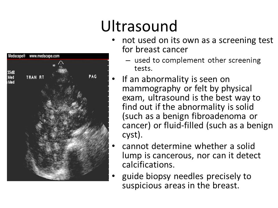 Ultrasound not used on its own as a screening test for breast cancer.