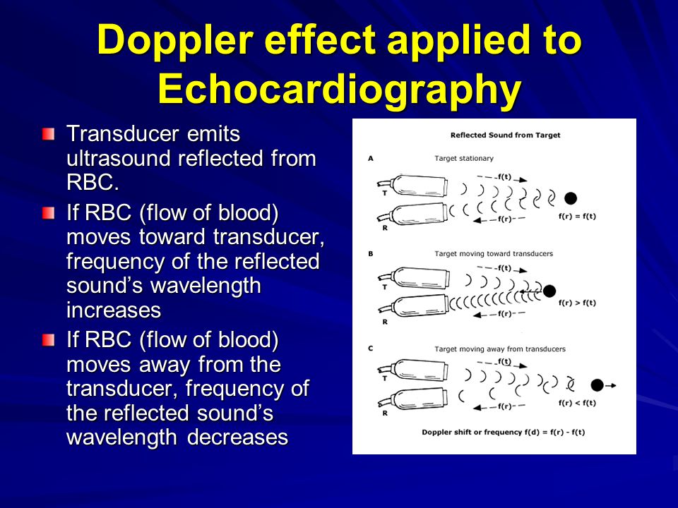 Доплер тон. Doppler Effect. Эффект Доплера в медицине. Эффект Доплера кровоток. Эффект Доплера звук.