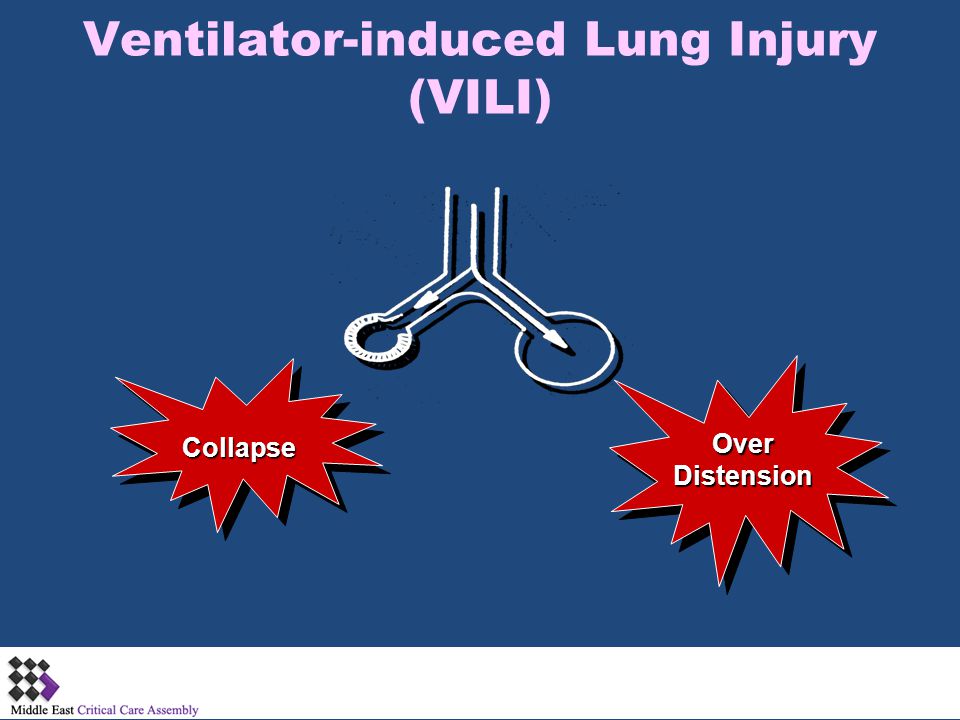 Complications of Mechanical Ventilation - ppt video online download