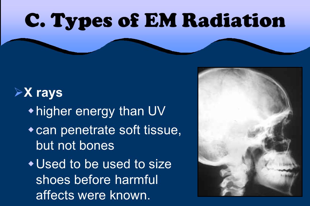 C. Types of EM Radiation X rays higher energy than UV
