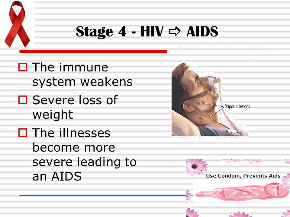 Stage 4 - HIV  AIDS The immune system weakens Severe loss of weight