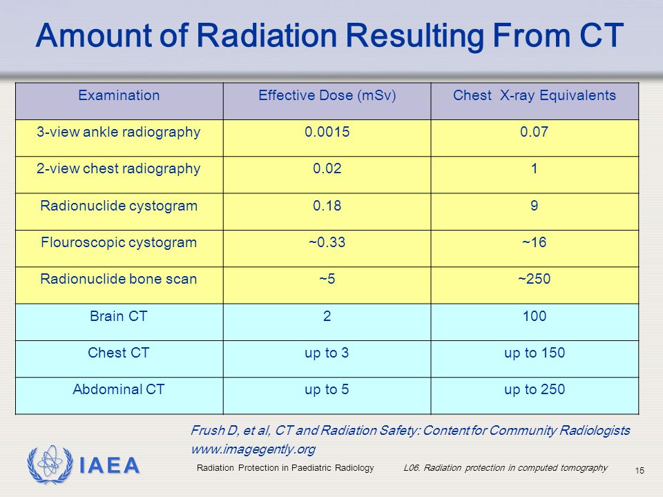 Ct Scan Radiation Dose Chart