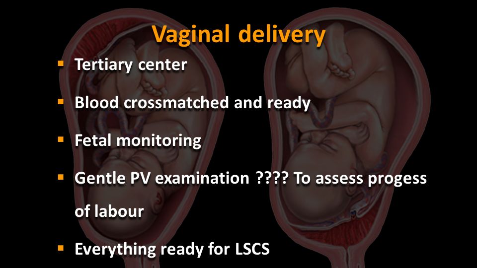Vaginal delivery Tertiary center Blood crossmatched and ready