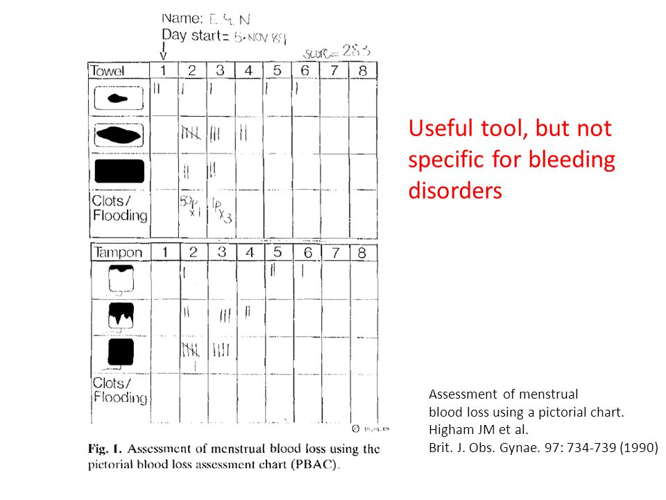 Pictorial Blood Assessment Chart Menorrhagia