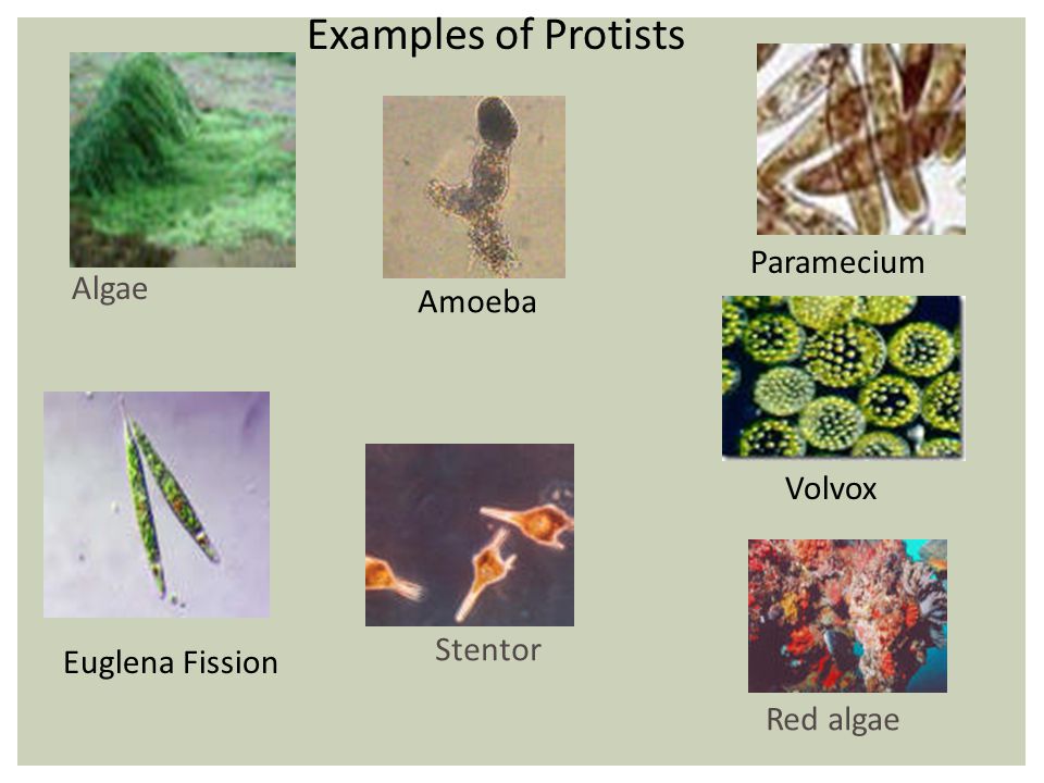 protista examples