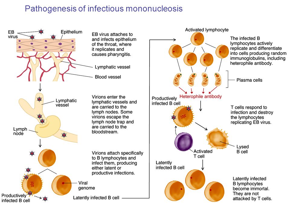 Мононуклеоз вирус эпштейна. Инфекционный мононуклеоз патогенез схема. Вирус Эпштейна-Барр патогенез. Вирус Эпштейна Барра патогенез. Патогенез мононуклеоза схема.
