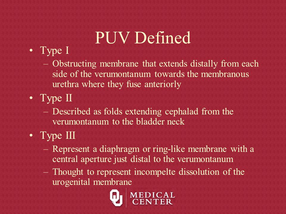 Posterior Urethral Valves Ppt Download