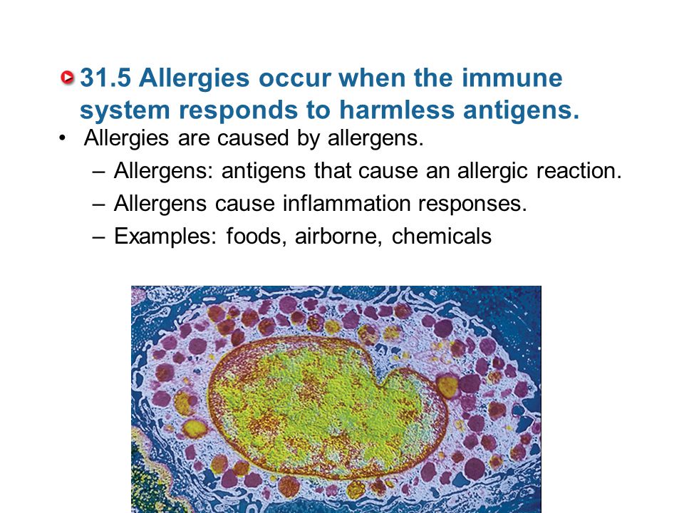 31.5 Allergies occur when the immune system responds to harmless antigens.