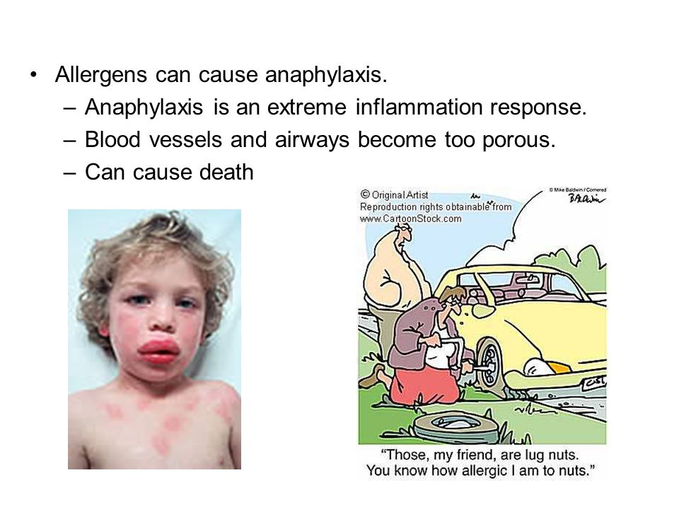 Allergens can cause anaphylaxis.