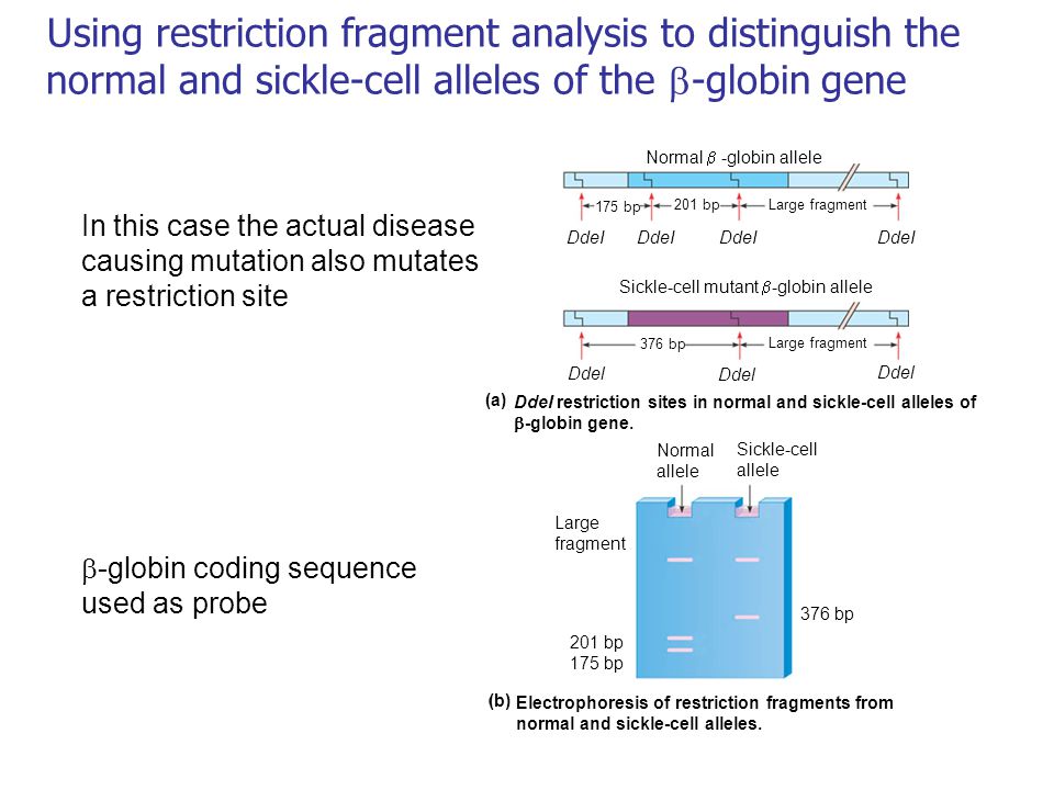 Using restriction fragment analysis to distinguish the normal and sickle-cell alleles of the -globin gene