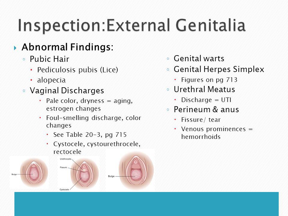 Candida Infection Tricpmonas Vaginalis Bacterial Vaginosis