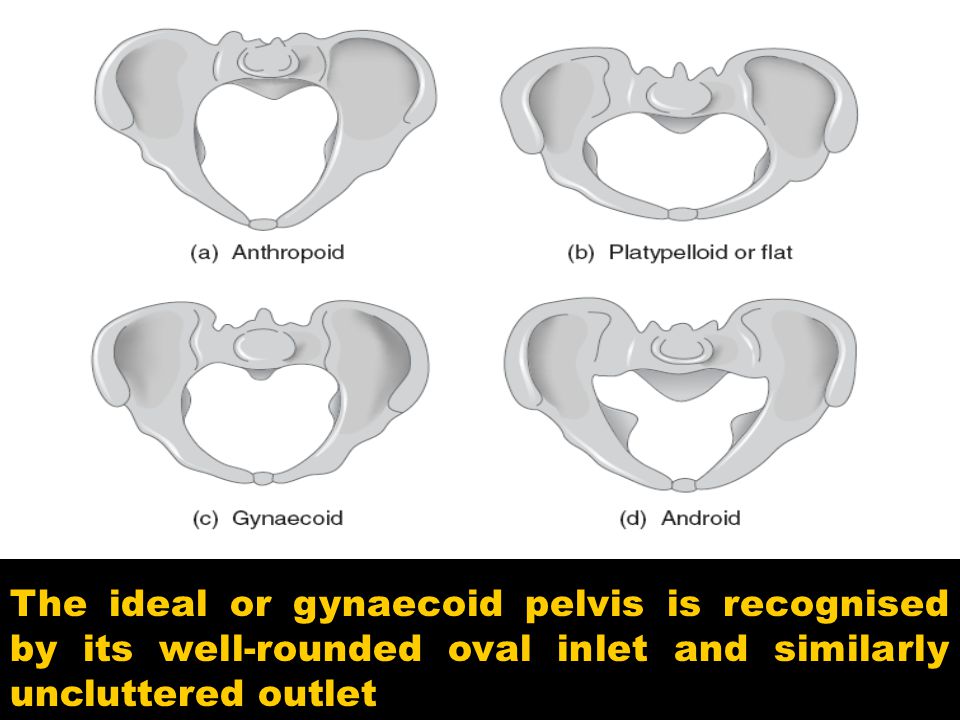The ideal or gynaecoid pelvis is recognised by its well-rounded oval inlet and similarly uncluttered outlet