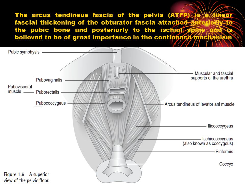 The arcus tendineus fascia of the pelvis (ATFP) is a linear fascial thickening of the obturator fascia attached anteriorly to the pubic bone and posteriorly to the ischial spine and is believed to be of great importance in the continence mechanism