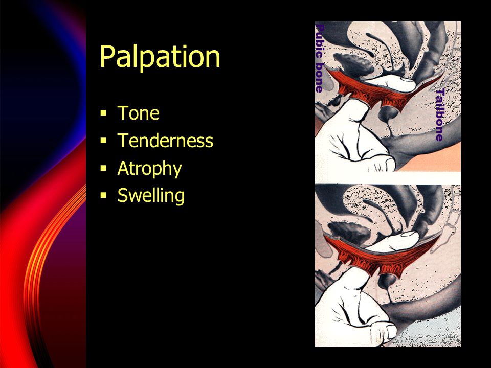 Palpation Tone Tenderness Atrophy Swelling