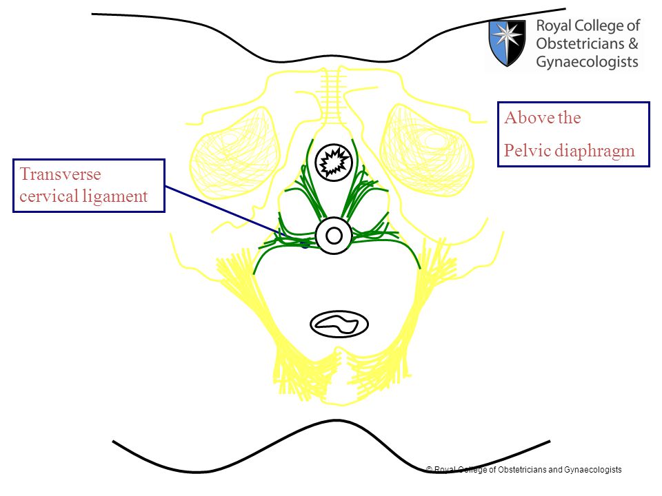 Above the Pelvic diaphragm Transverse cervical ligament