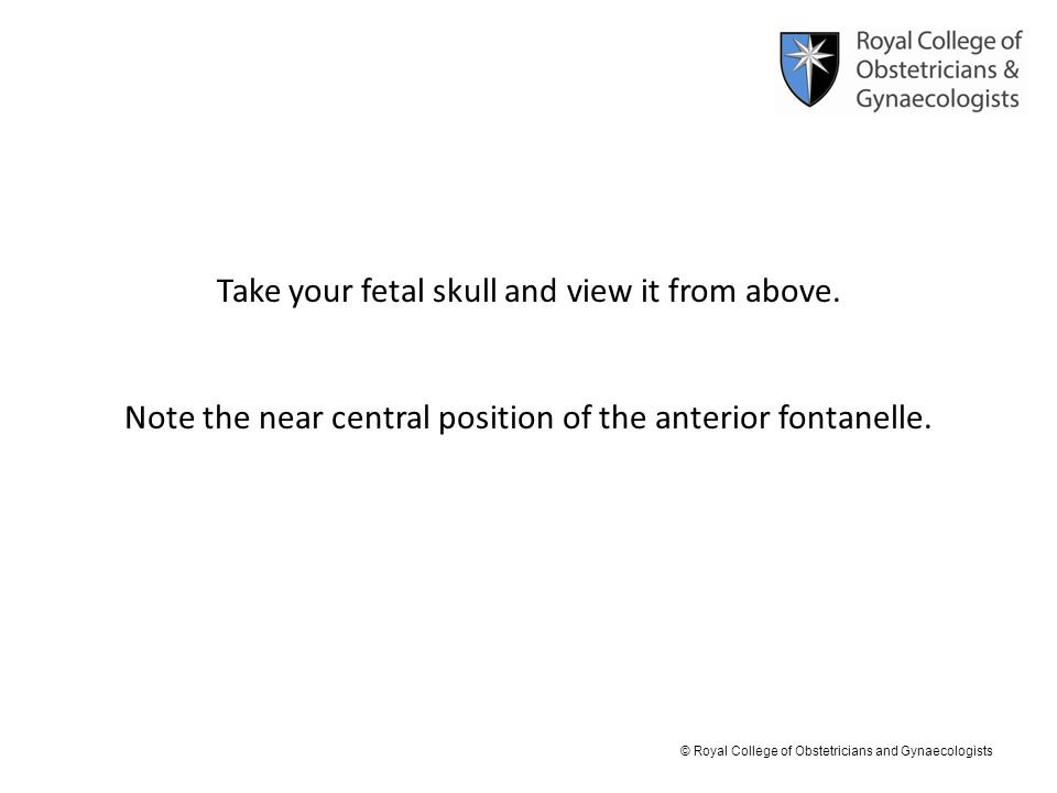 Take your fetal skull and view it from above.