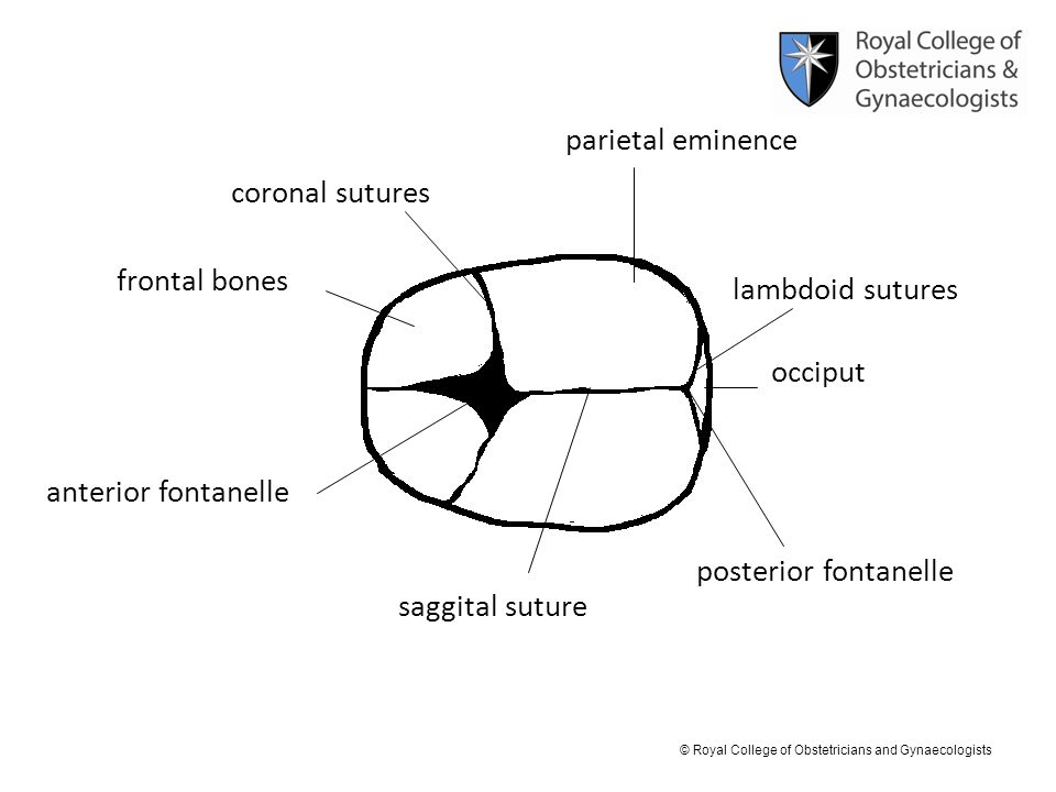 parietal eminence coronal sutures. frontal bones. lambdoid sutures. occiput. anterior fontanelle.