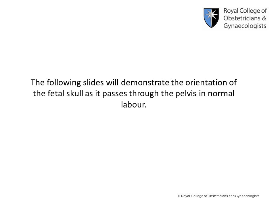 The following slides will demonstrate the orientation of the fetal skull as it passes through the pelvis in normal labour.