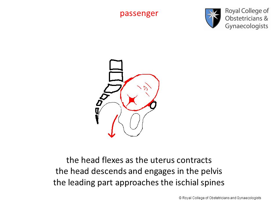 the head flexes as the uterus contracts