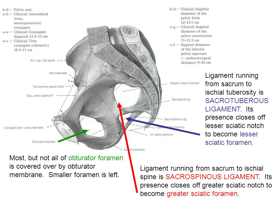 Ligament running from sacrum to ischial tuberosity is SACROTUBEROUS LIGAMENT. Its presence closes off lesser sciatic notch to become lesser sciatic foramen.