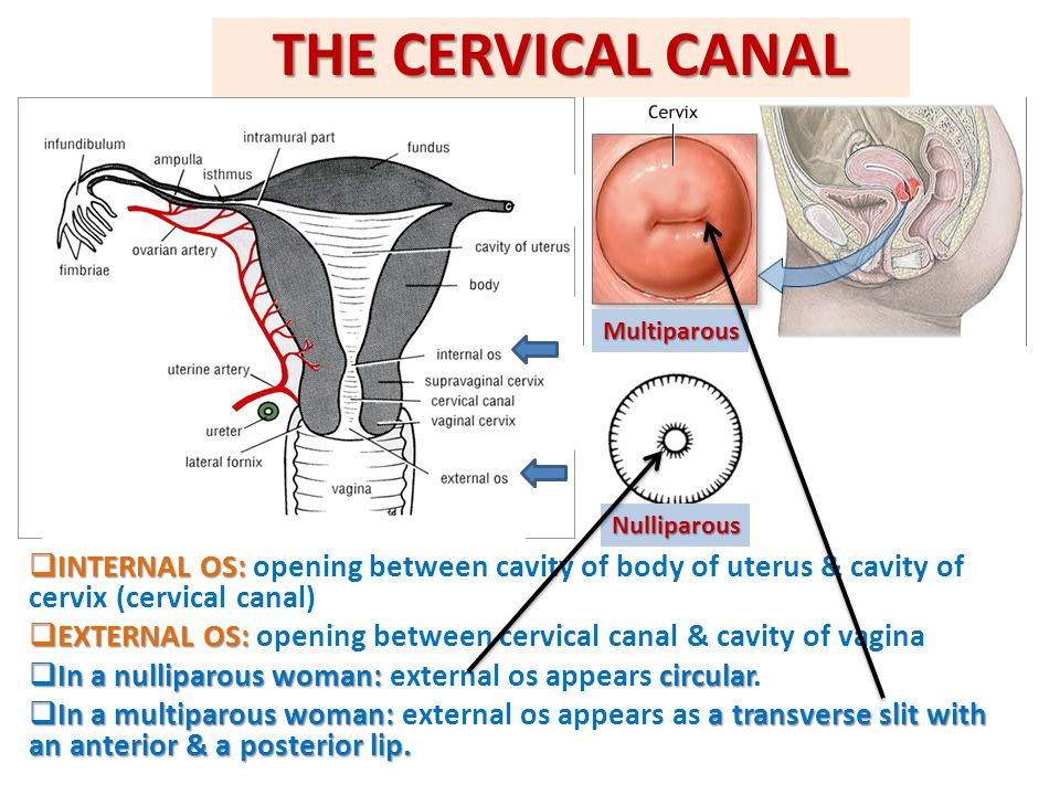 THE CERVICAL CANAL Multiparous. Nulliparous. INTERNAL OS: opening between cavity of body of uterus & cavity of cervix (cervical canal)