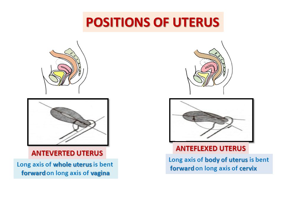 Long axis of whole uterus is bent forward on long axis of vagina
