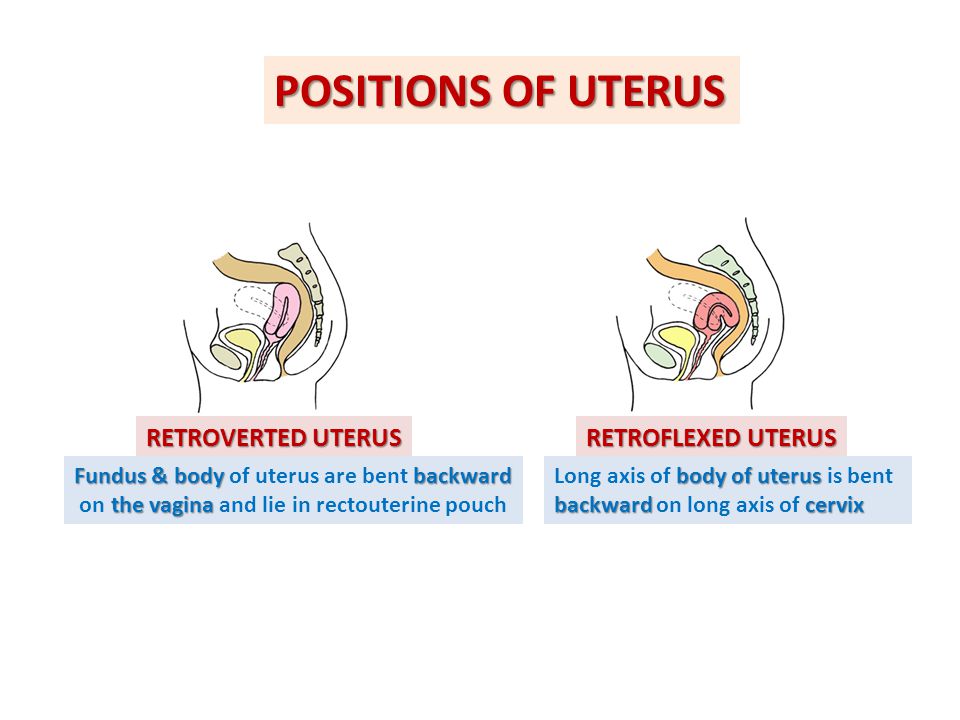 Fundus & body of uterus are bent backward. on the vagina and lie in rec...