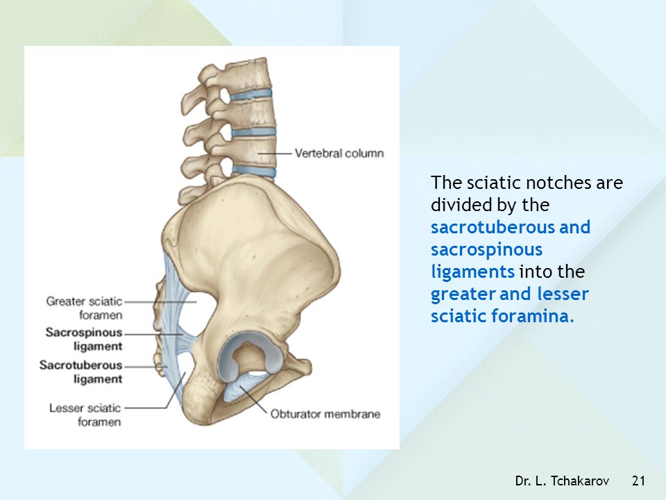 The sciatic notches are divided by the sacrotuberous and sacrospinous ligaments into the greater and lesser sciatic foramina.