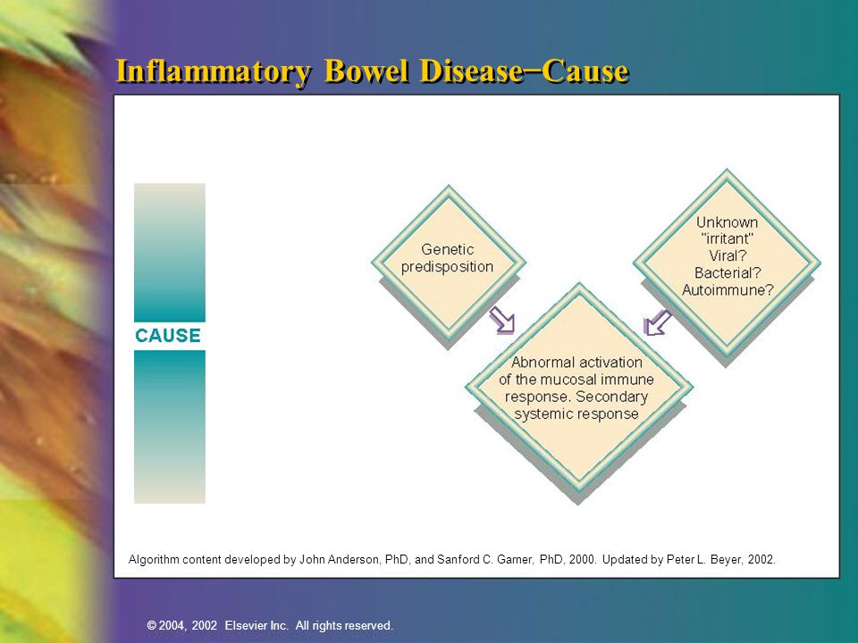 Inflammatory Bowel Disease−Cause