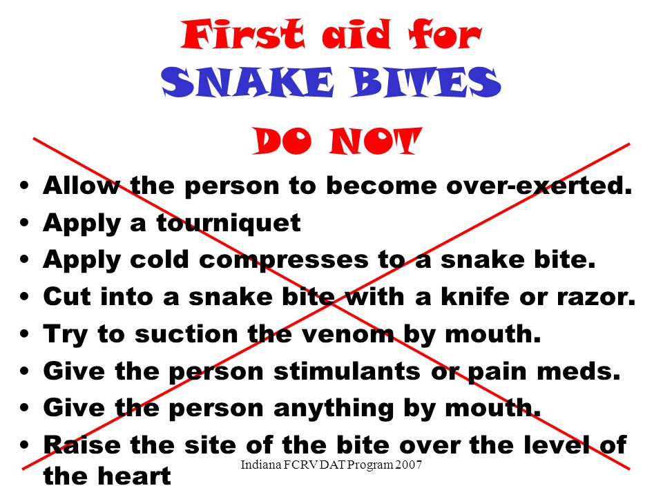 First aid for SNAKE BITES