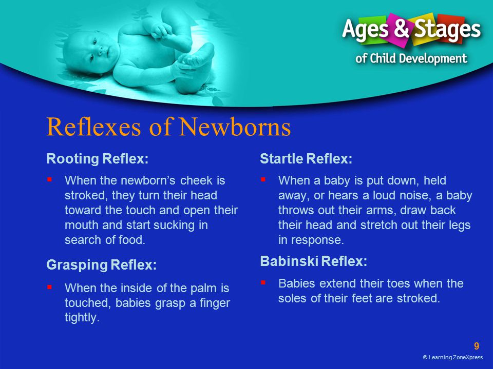 Reflexes of Newborns Rooting Reflex: Grasping Reflex: Startle Reflex:
