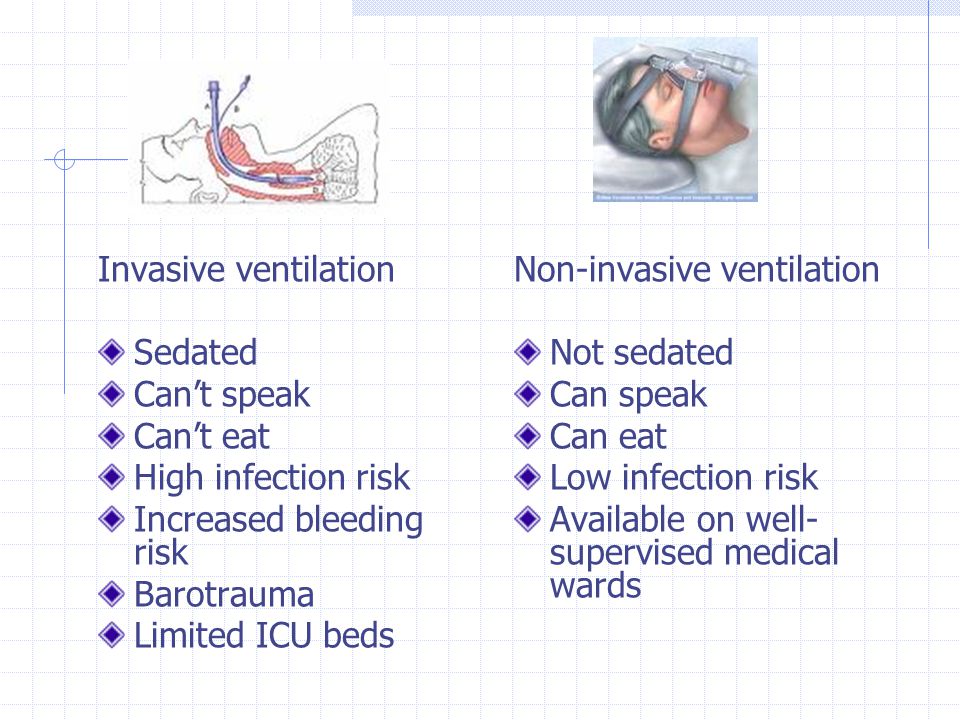 Non-invasive Ventilation - ppt video online download