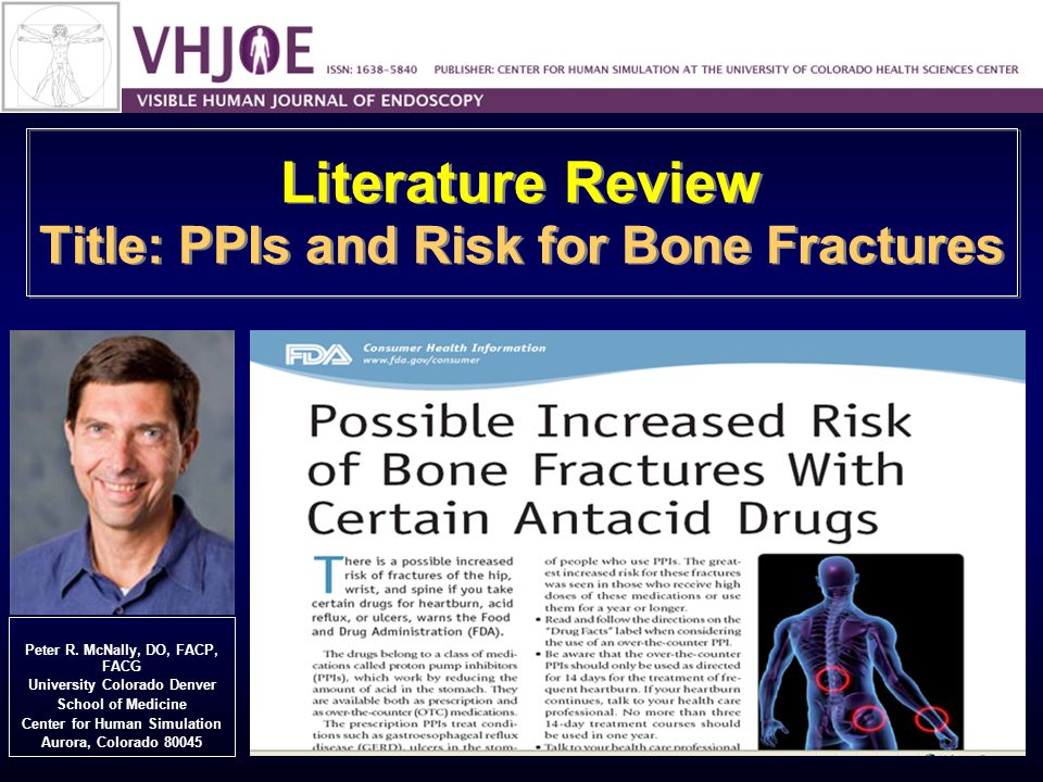 ppi and bone fractures ile ilgili görsel sonucu