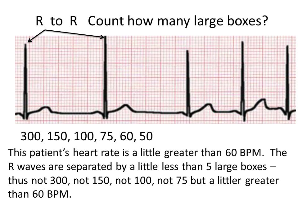 Ekg Mike Clark M D Ppt Video Online Download Ekg Mike Clark M D Ppt Video Online Download