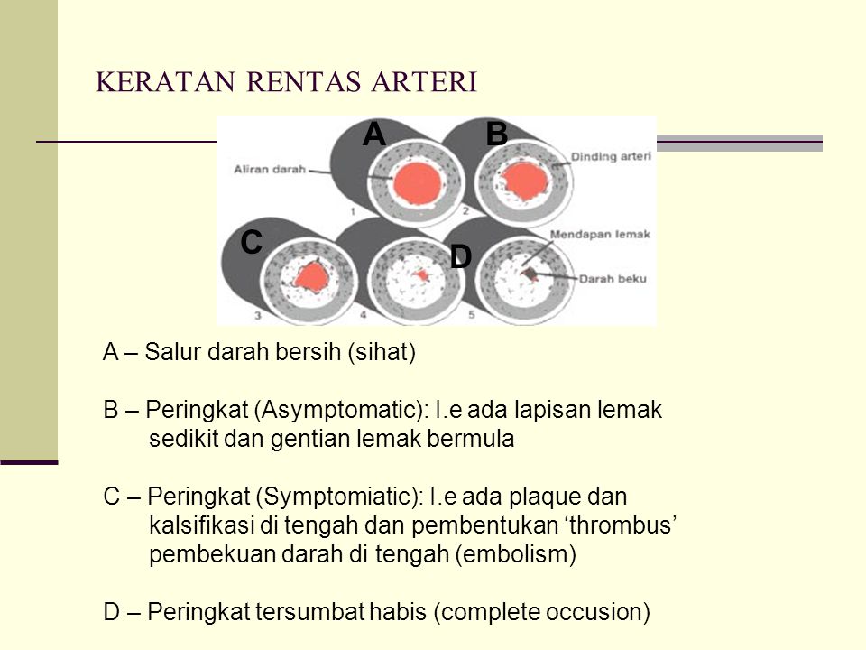Makanan Seimbang Hipertensi Amalan Untuk Mencegah Hipertensi Diet