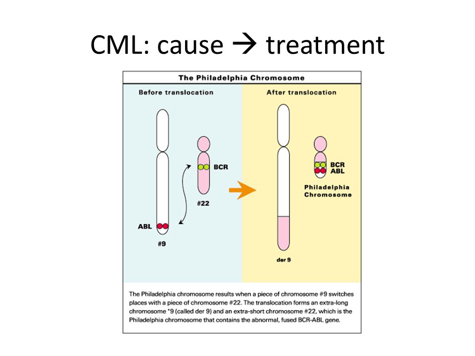 CML: cause  treatment
