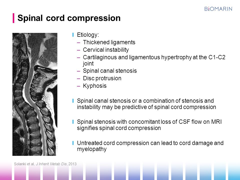 Spinal cord compression