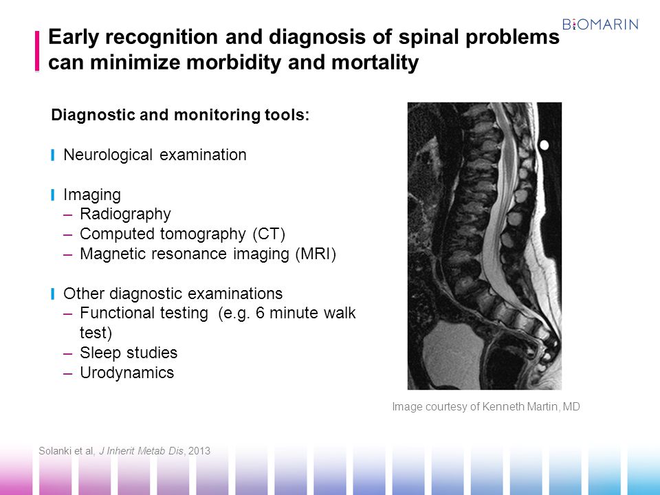 Early recognition and diagnosis of spinal problems can minimize morbidity and mortality