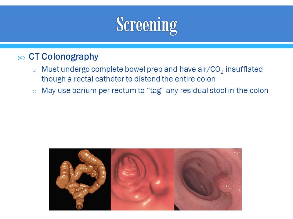 Screening CT Colonography