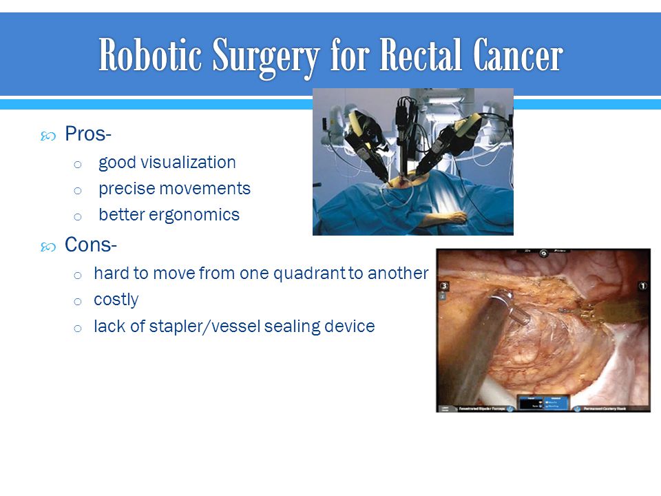Robotic Surgery for Rectal Cancer