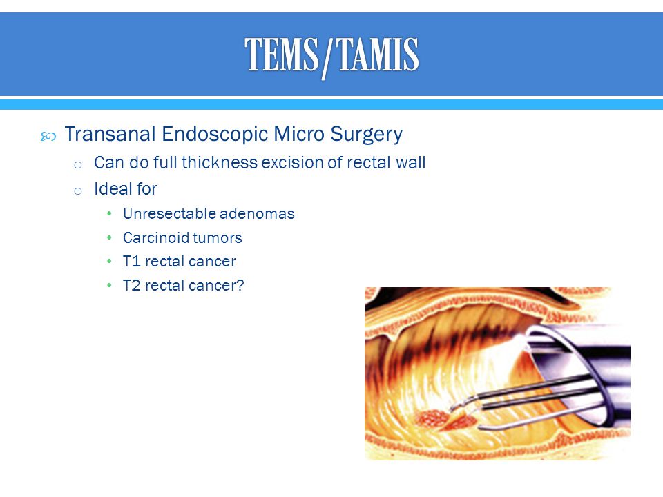 TEMS/TAMIS Transanal Endoscopic Micro Surgery