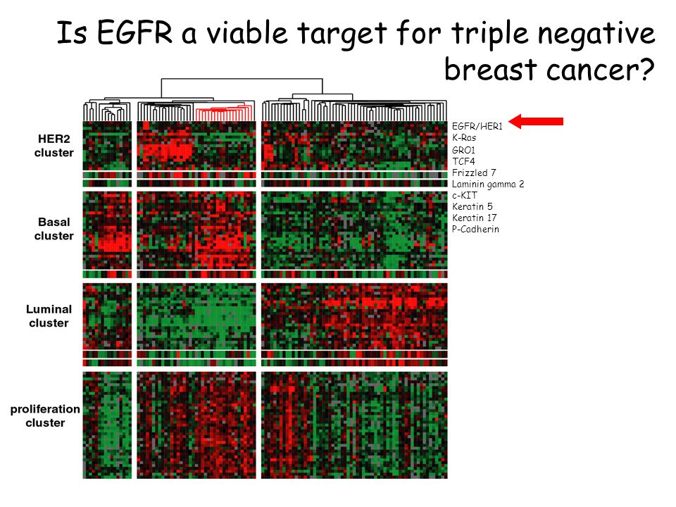Is EGFR a viable target for triple negative breast cancer