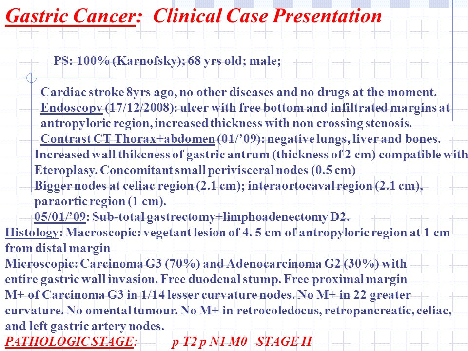 gastric cancer case presentation