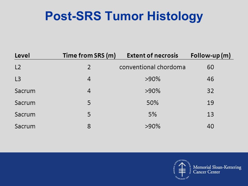 Post-SRS Tumor Histology